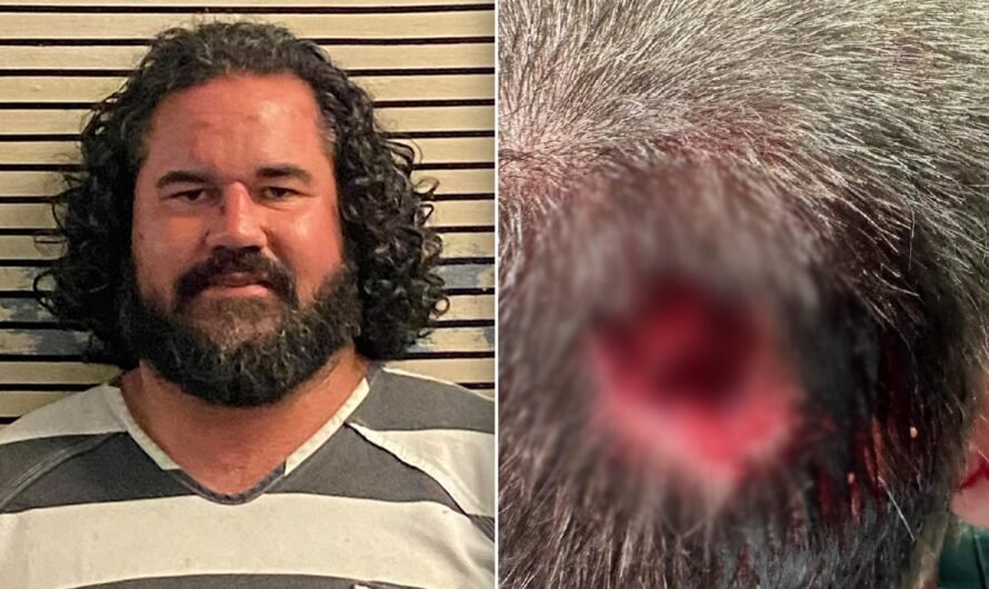 Florida man bit chunk out of deputy’s head at music festival: sheriff’s office