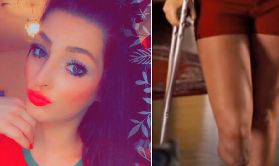 24-Year-Old Woman’s Leg AMPUTATED After Getting Tiny Blister From Wearing Sneakers!