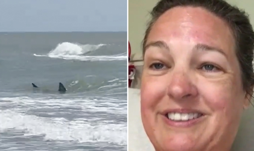 Texas South Padre Island shark attack survivor says her leg is ‘pretty much gone’