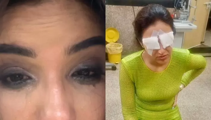 Jasmin Bhasin Suffers Corneal Damage After Lens Mishap, ‘I Couldn’t See Anything, Pain Intensified’